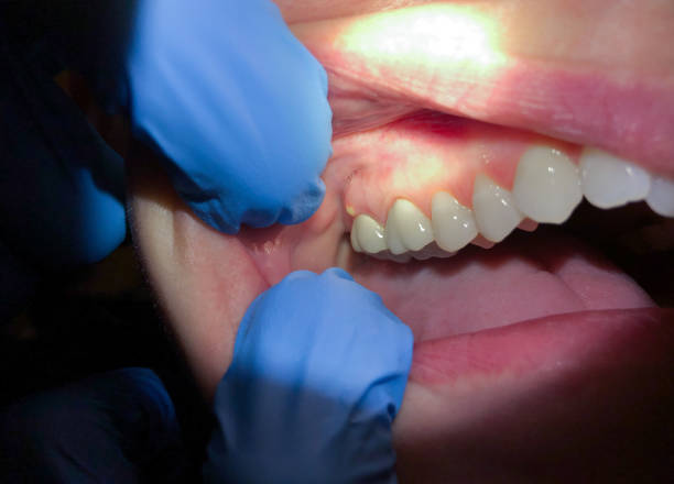 Best Walk-In Emergency Dentist in Ball Ground, GA